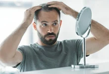 علت ریزش موی مردان و جدیدترین راه‌های درمان آن چیست؟