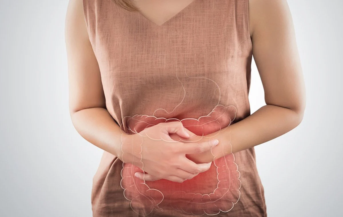 type of intestinal polyps